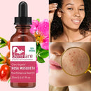 Óleo Vegetal de Rosa Mosqueta Dermare 100% Puro Extra Virgem Hidratação Regeneração Proteção da Pele